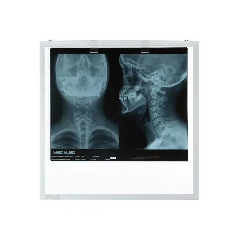 ibspot-36806509